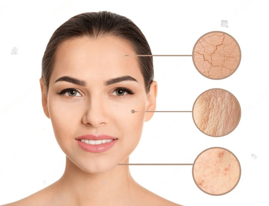 Everything You Need to Know About Different Skin Types